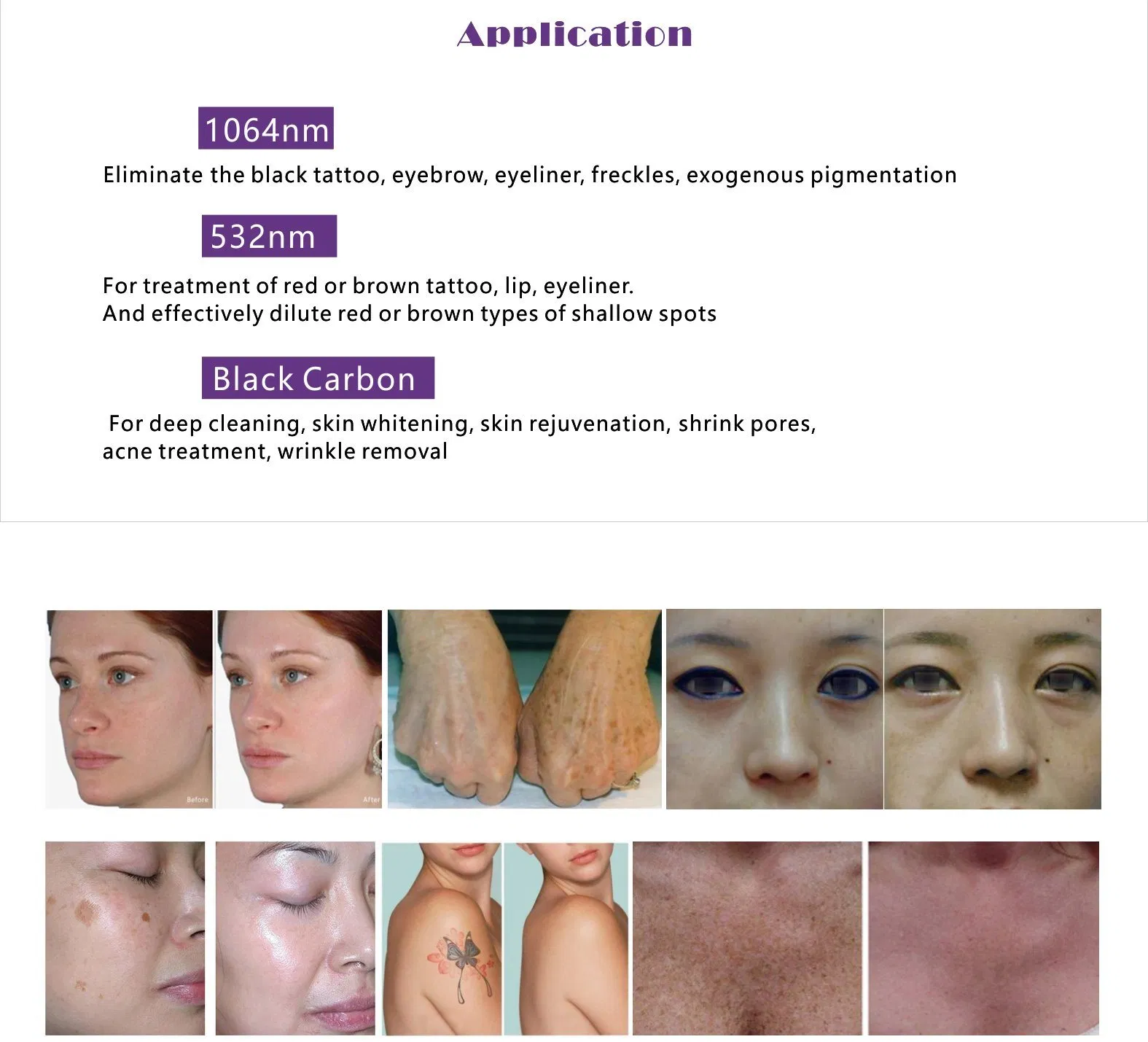 Newest 2400W High Power Diode Laser 3 Wavelength Painless Hair Removal Laser Machine