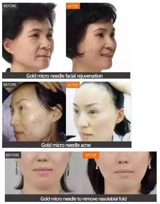 Treatment Comparison