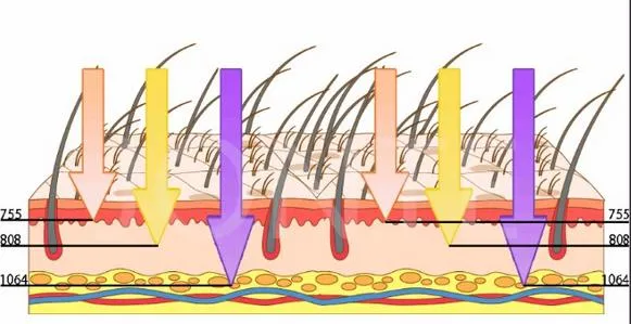 Diode Laser Technology