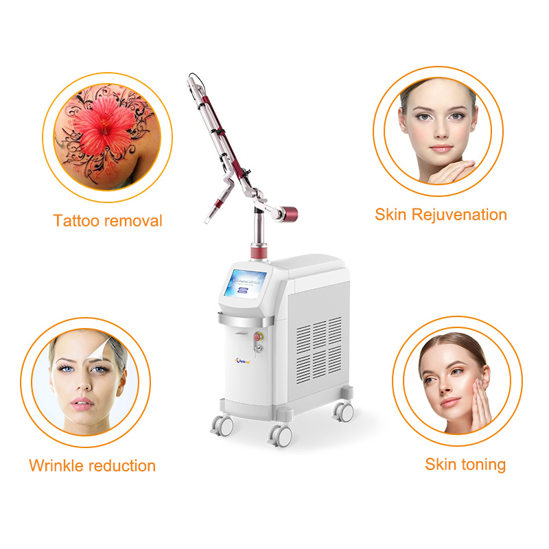 Q Switch Laser Tattoo Removal Device Eo (Electro-optical) Q-Switched ND YAG Laser Tattoo-Removal System for Tattoo Removal Skin Rejuvenation