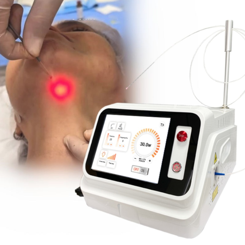 Surgical Face Lifting Fat Loss Diode Laser System with Fiber Optic Lifting Laser Liposuction Machine Endolaser 980nm 1470nm