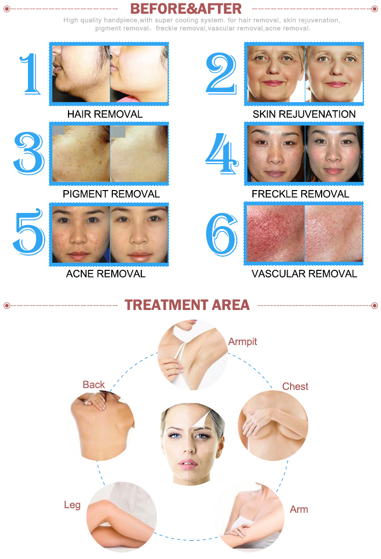 Best and Stronger Power Machine IPL Hair Removal Laser