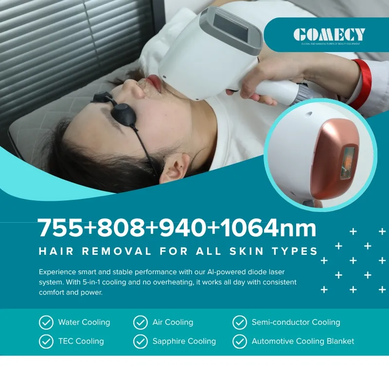 Laser Hair Removal System