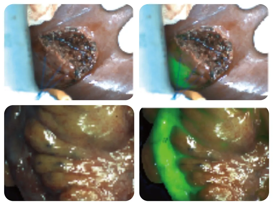 Margin determination