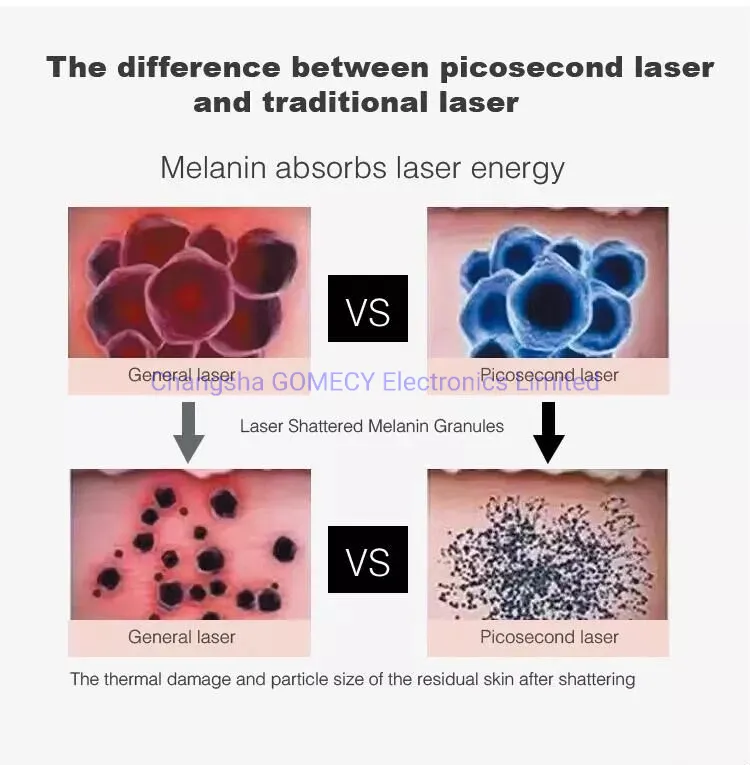 Pico Laser Theory