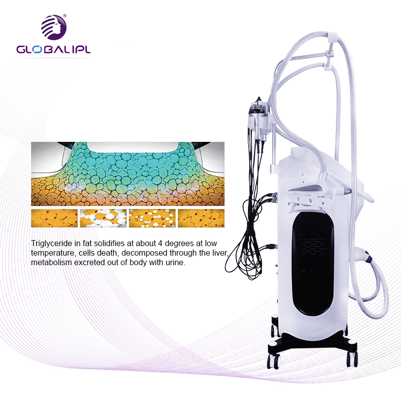 Globalipl Quality Fat Freezing Vacuum Slimming Device Cryo Weight Reduction