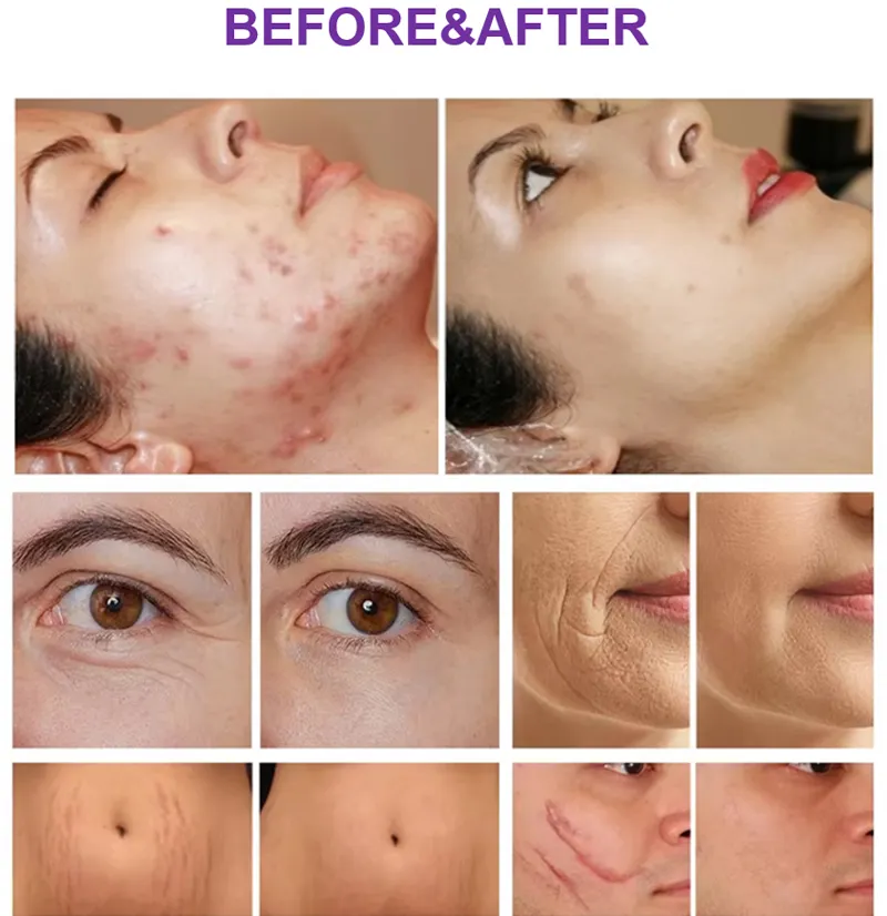 Before and After Results