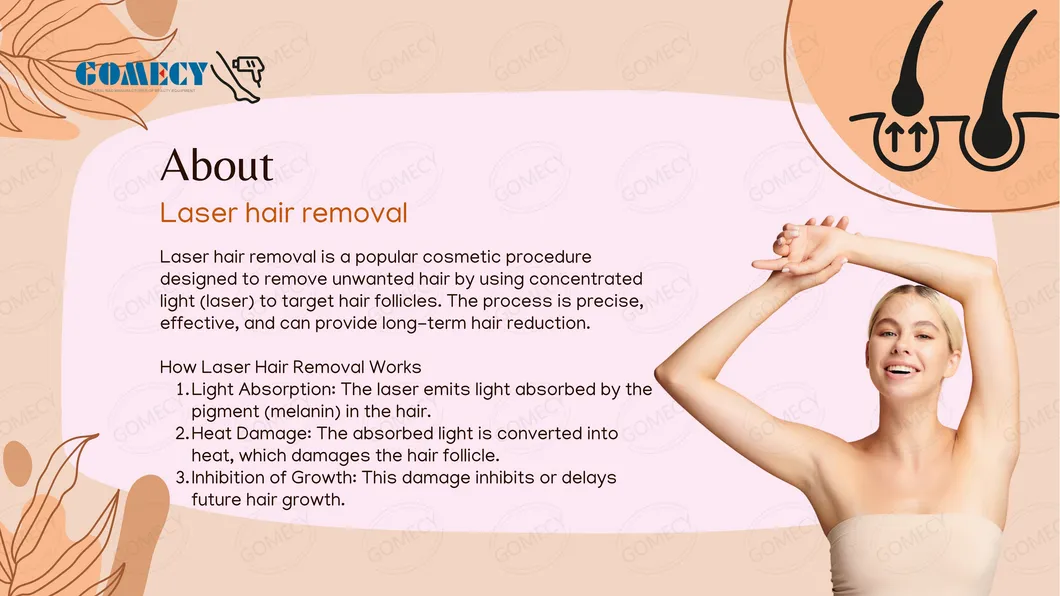 Laser Hair Removal Principle