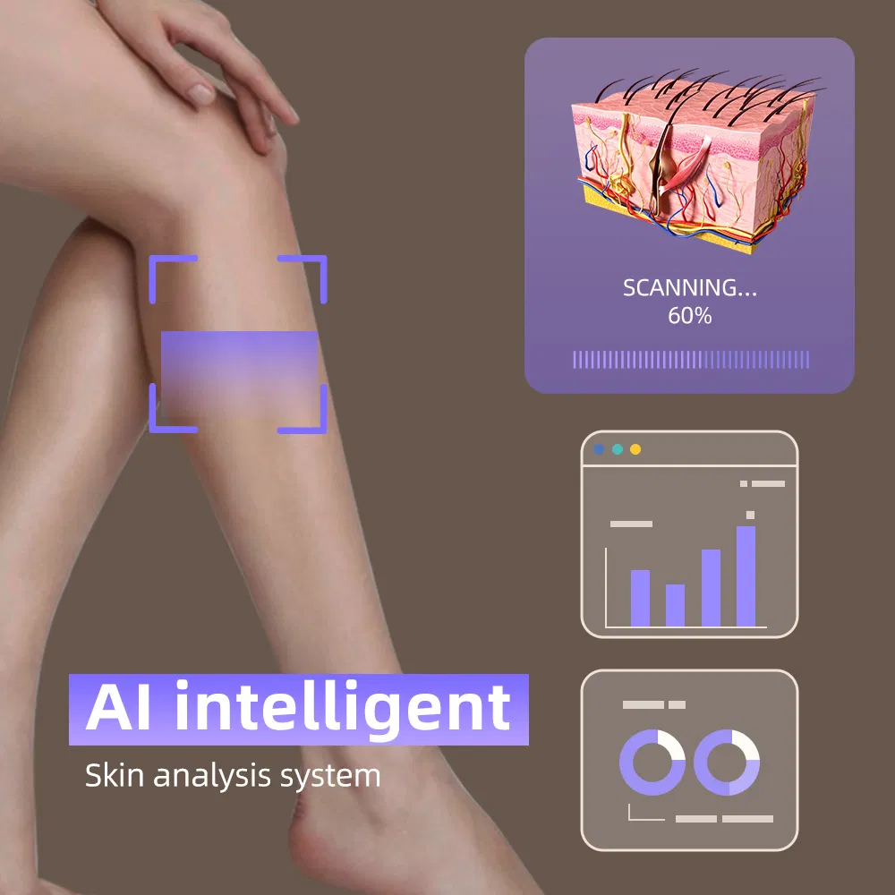 Km 808nm Diode Laser 755 808 1064nm Triple Wavelength Hair Removal for Fitzpatrick Skin Types I-VI