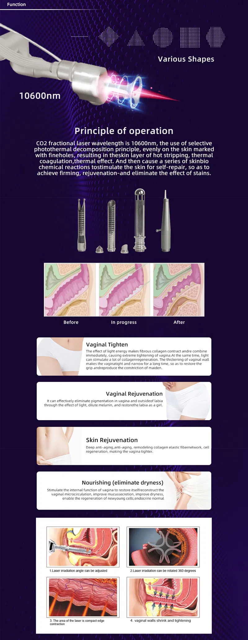 Treatment Features 1