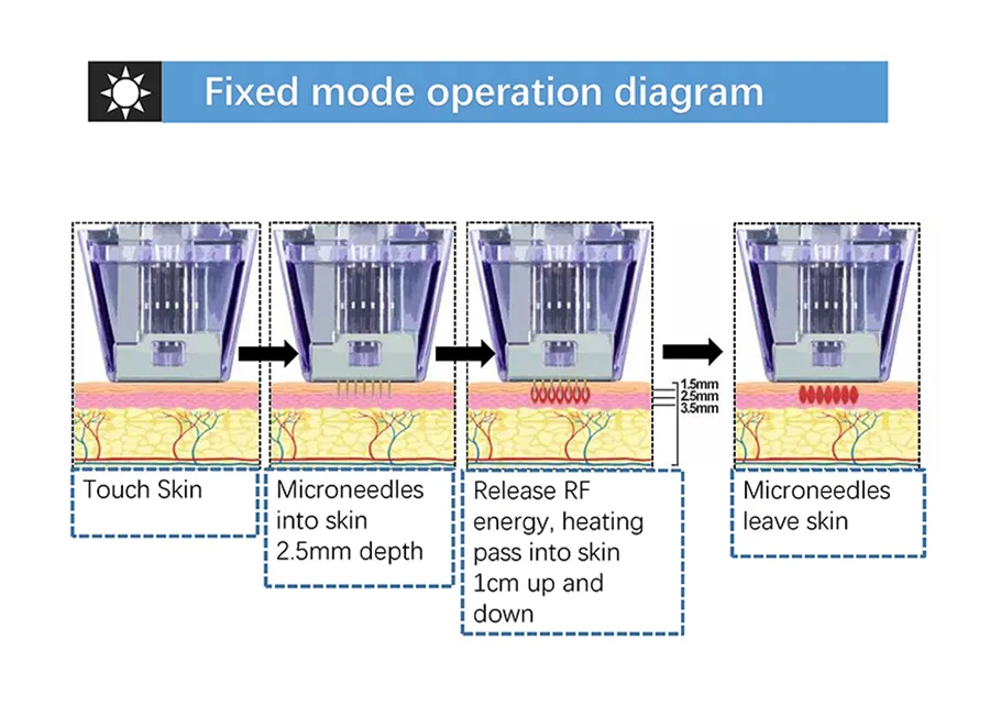 Microneedle RF System 3