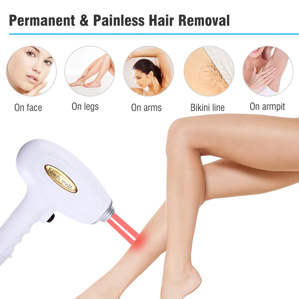 OEM Efficient 3 Wavelengths 755nm, 808nm, 1064nm 5 Million Shots Diode Laser Hair Removal Device