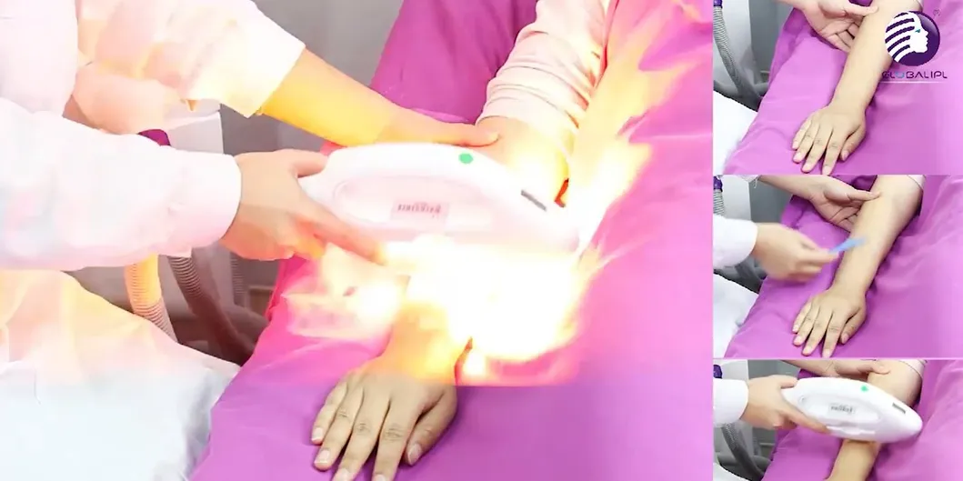 Skin Therapy Results