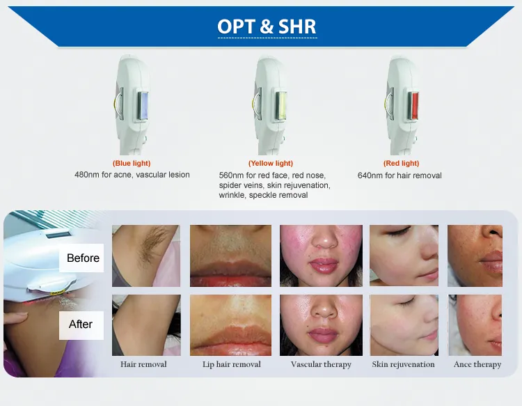 Beauty Machine Details