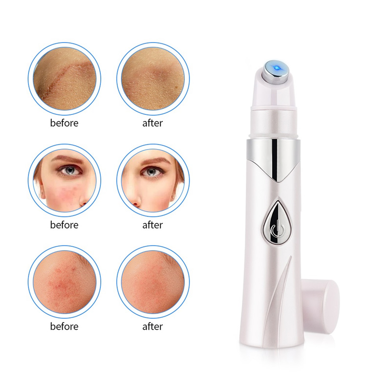 Portable Wrinkle Removal Acne Laser Anti Acne Treatment Removal Pen Beauty Device