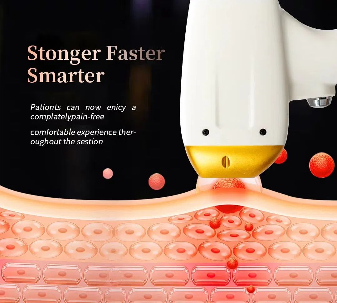 Newest 3 Wavelengths Optional 1064 755 808 Hair Removal Triple Wavelength Diode Laser 808nm