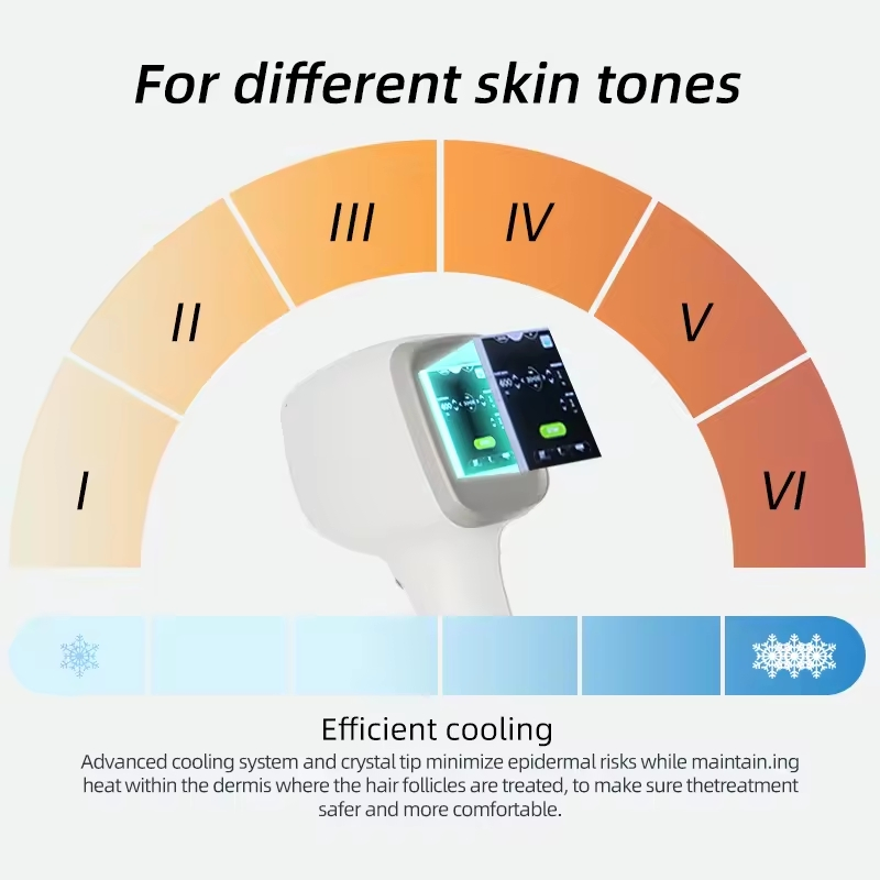 808nm High Power Diode Laser Hair Removal Machine Professional Hair Loss 2 Years Warranty Bikini Line Hair Reduction Equipment