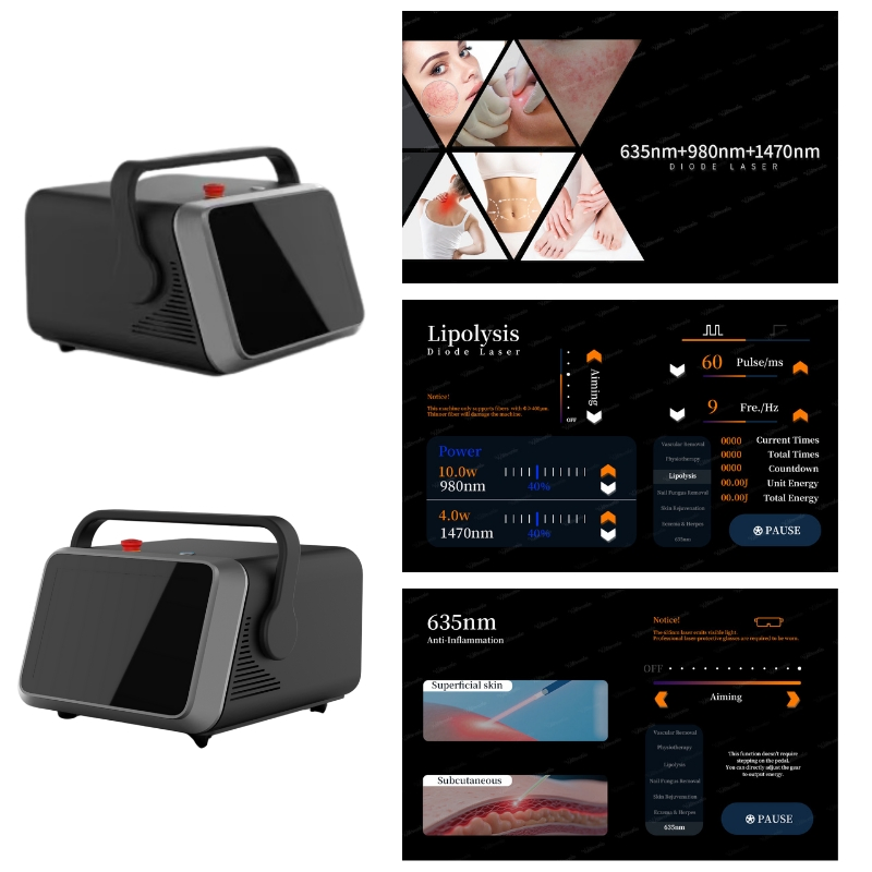 Smart Diode Laser System for Fat Reduction Pain and Skin Rejuvenation