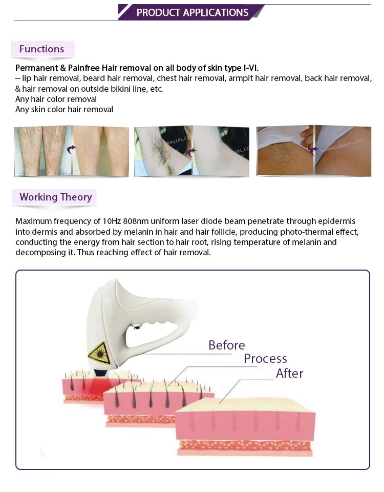 Hair Removal Treatment Effect