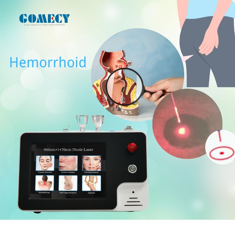 Gomecy Portable Acne Treatment Endolaser Evlt 980 with 1470 Endolifting Gomecy Facial Laser Diode Machine for Hemorrhoids Desktop Style
