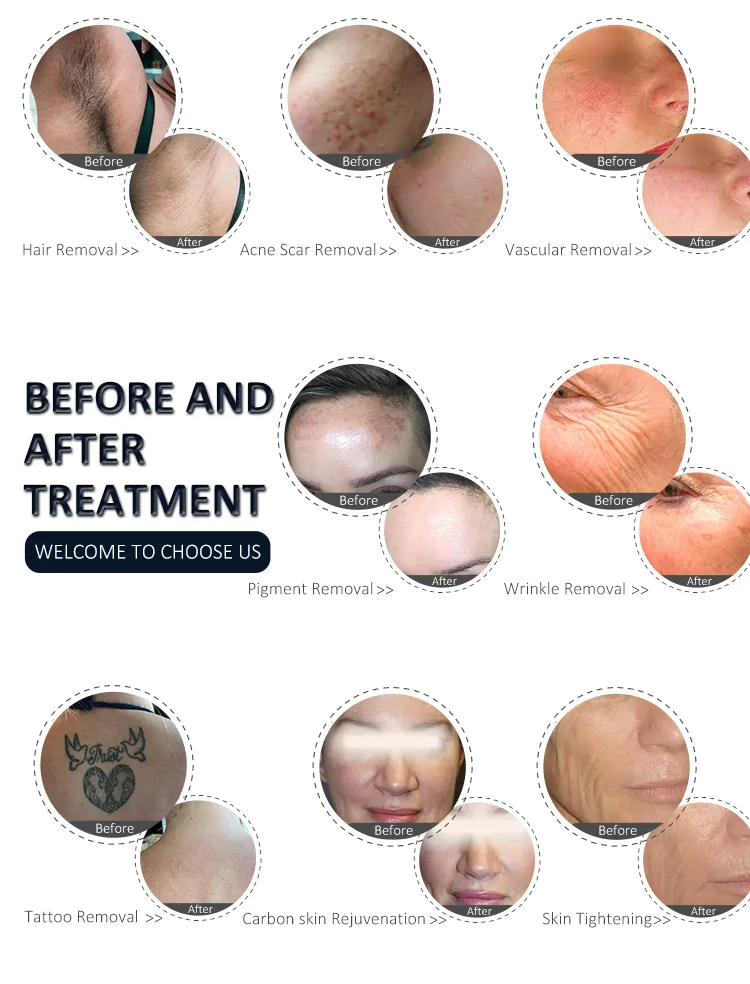 Sapphire Filters Detail