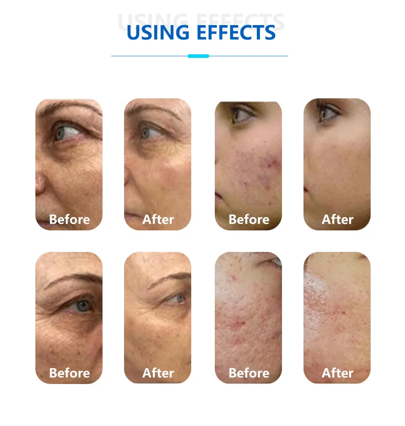 Before and After Results