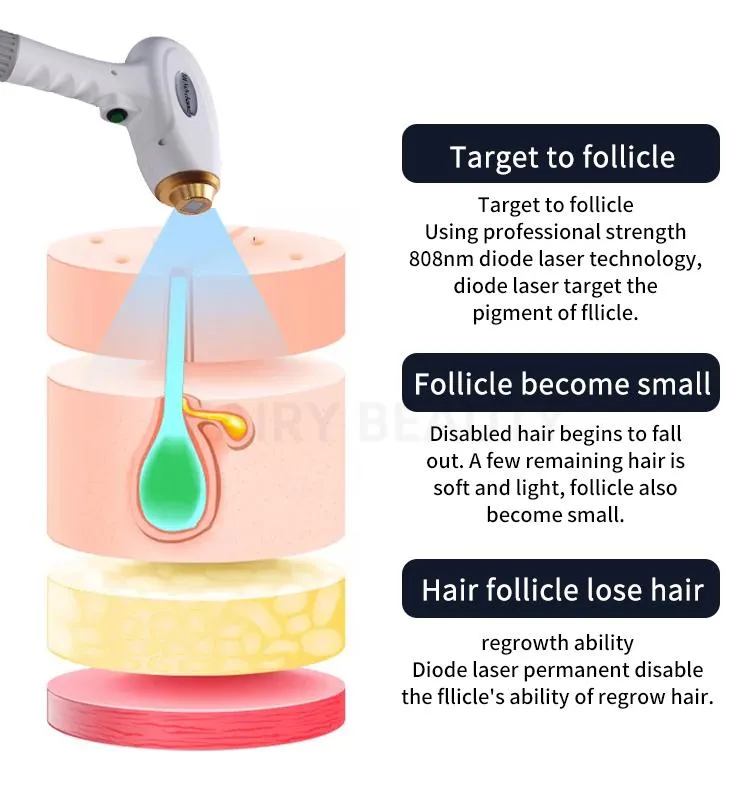 Diode Laser Advantages