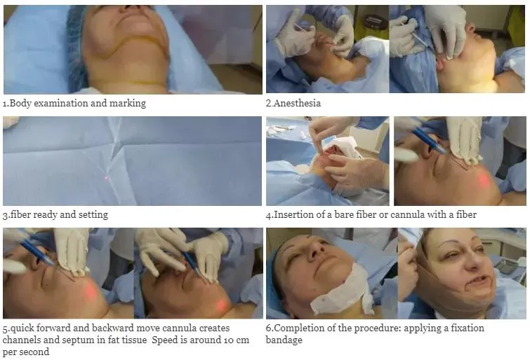 Surgery Process