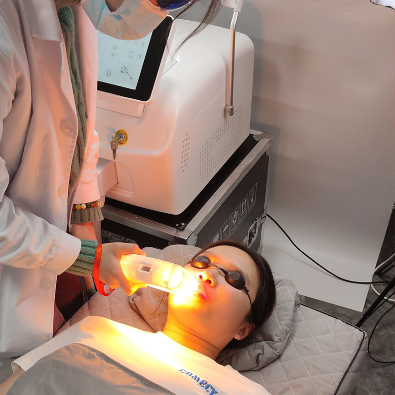 High Quality 3 in 1 IPL Opt Elight + RF + ND YAG Laser Carbon Laser Peel Skin Rejuvenation Acne Pigment Hair Removal Machine