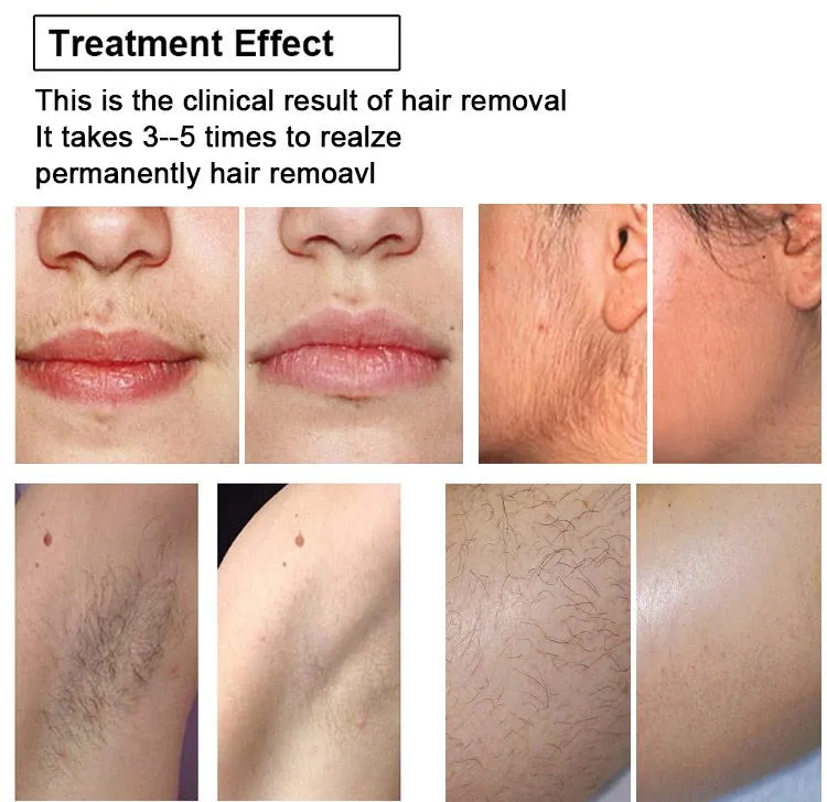 Treatment Results