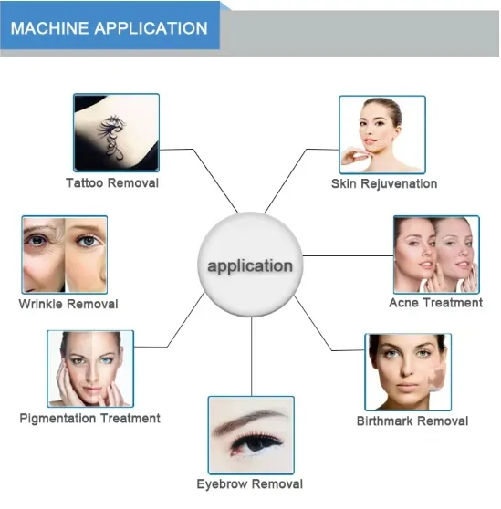 Application Treatment