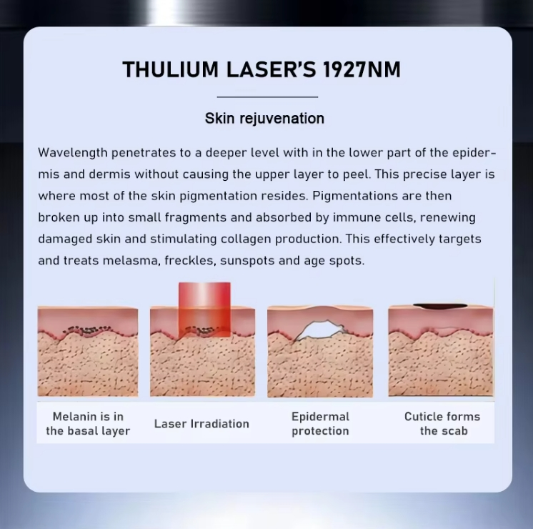 Medical Thulium Laser 1927nm Pigmentation Wrinkle and Acne Scar Removal Skin Rejuvenation Beauty System