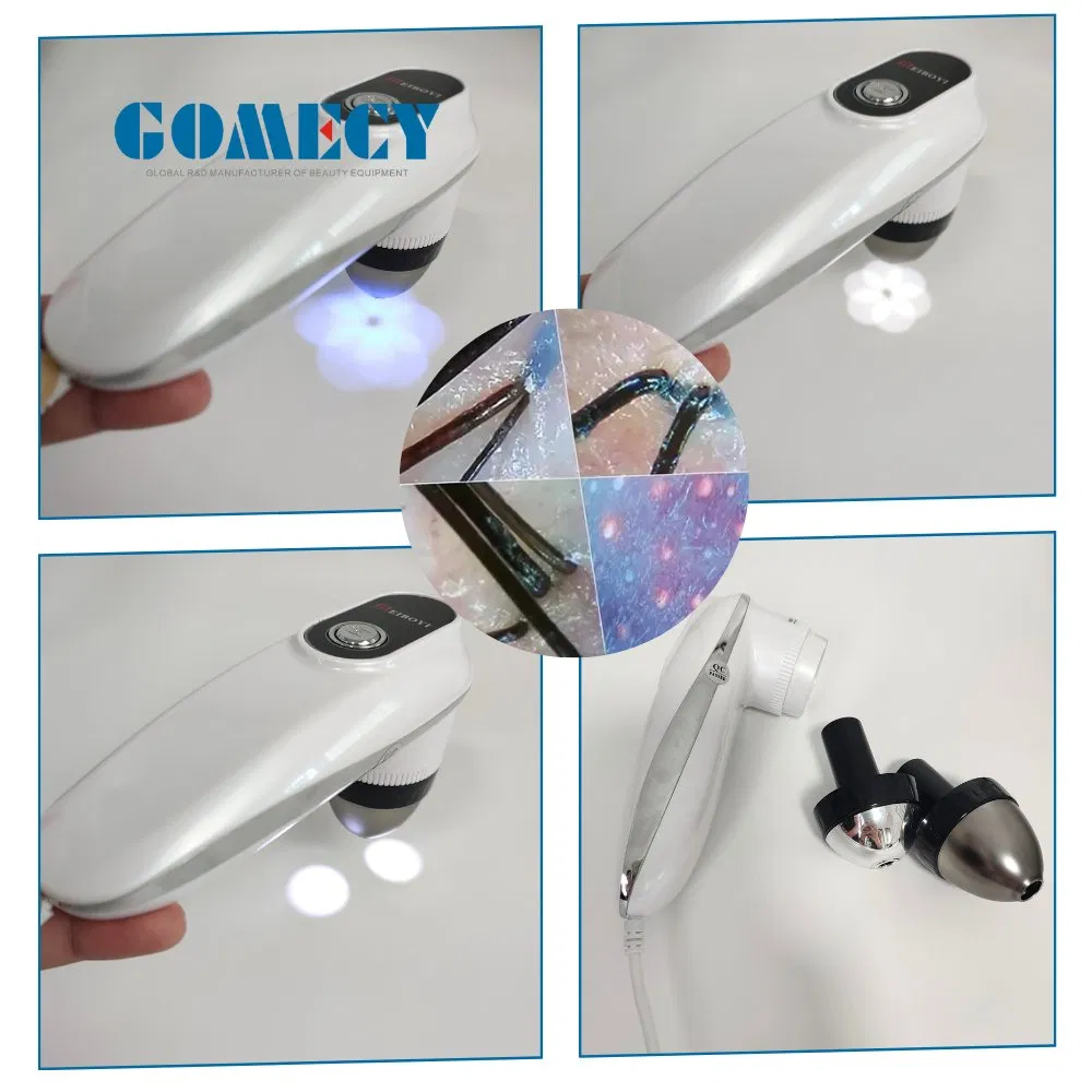 Gomecy 2025 Hot Model High Power 808nm 755 1064 Diode Laser Stack Bars for Professional Skin Treatments with Skin Analyzer Equipment