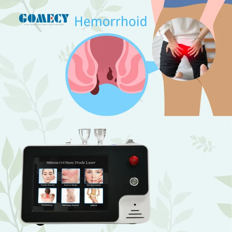 Laser Diode Machine View 2