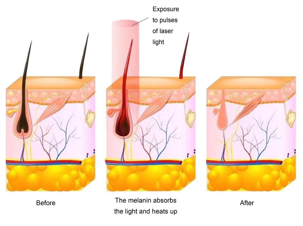Laser Machine View 2