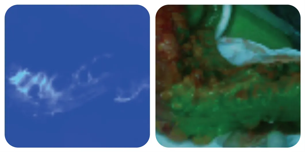 Anastomotic evaluation