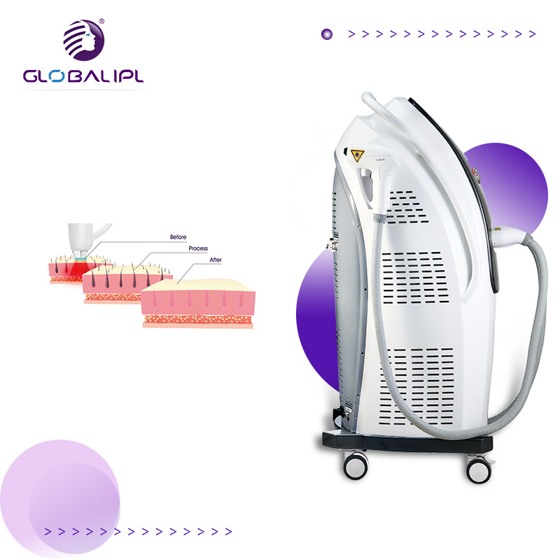 Speed 808 Diode Laser Hair Removal Black Skin Hair Removal Skin Rejuvenation Machine