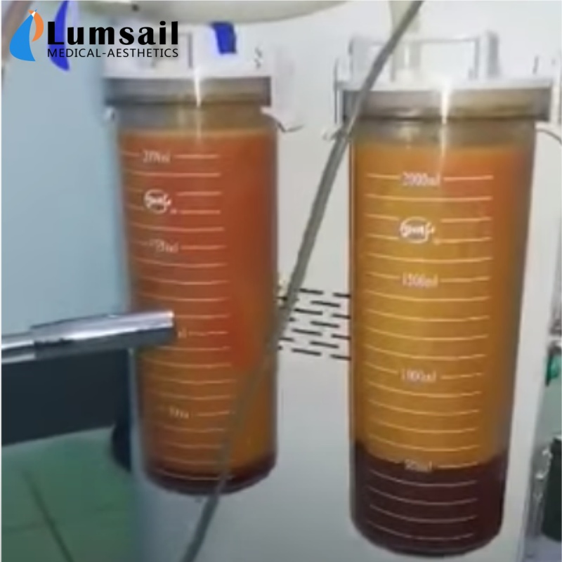 Stable Surgical PAL Liposuction Machine for Plastic Surgical with Different Canula