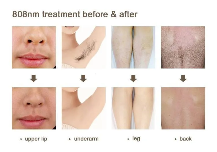 Before and After Treatment