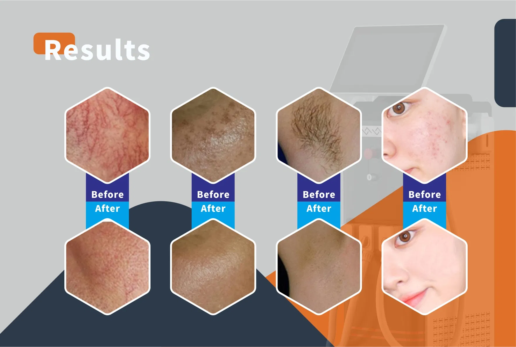 Laser Machine View 6