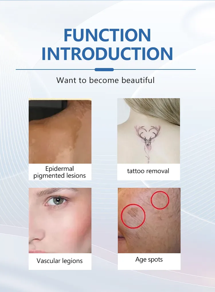 Skin treatment visual