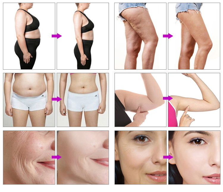 Before & After Results