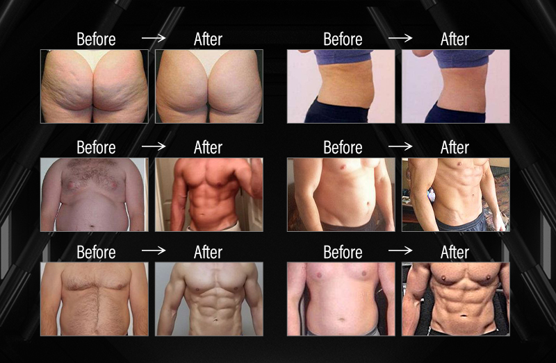 Treatment Results
