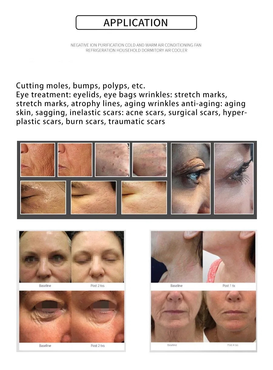 Skin Tightening Anti-Aging Double Handles Plasma Lifting Therapy Cold Plasma Cutting Mole Removal Plasma Beauty Machine