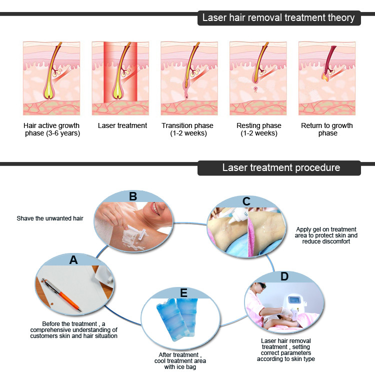 Laser Penetration Diagram