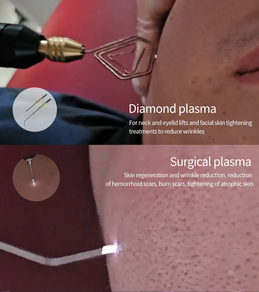 Skin Treatment Machine Scalp Care Jet Plasma Wrinkle Removal Skin Tightening Machine