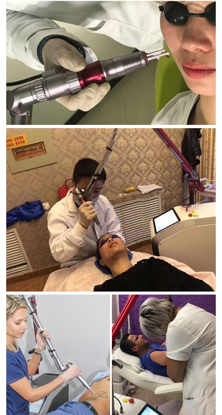 Before and after case 2