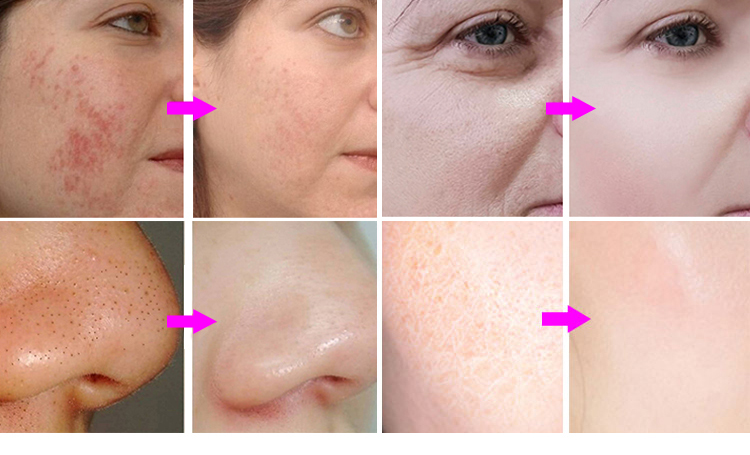 Before and After Results