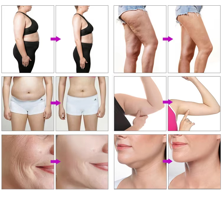 Before and After Results