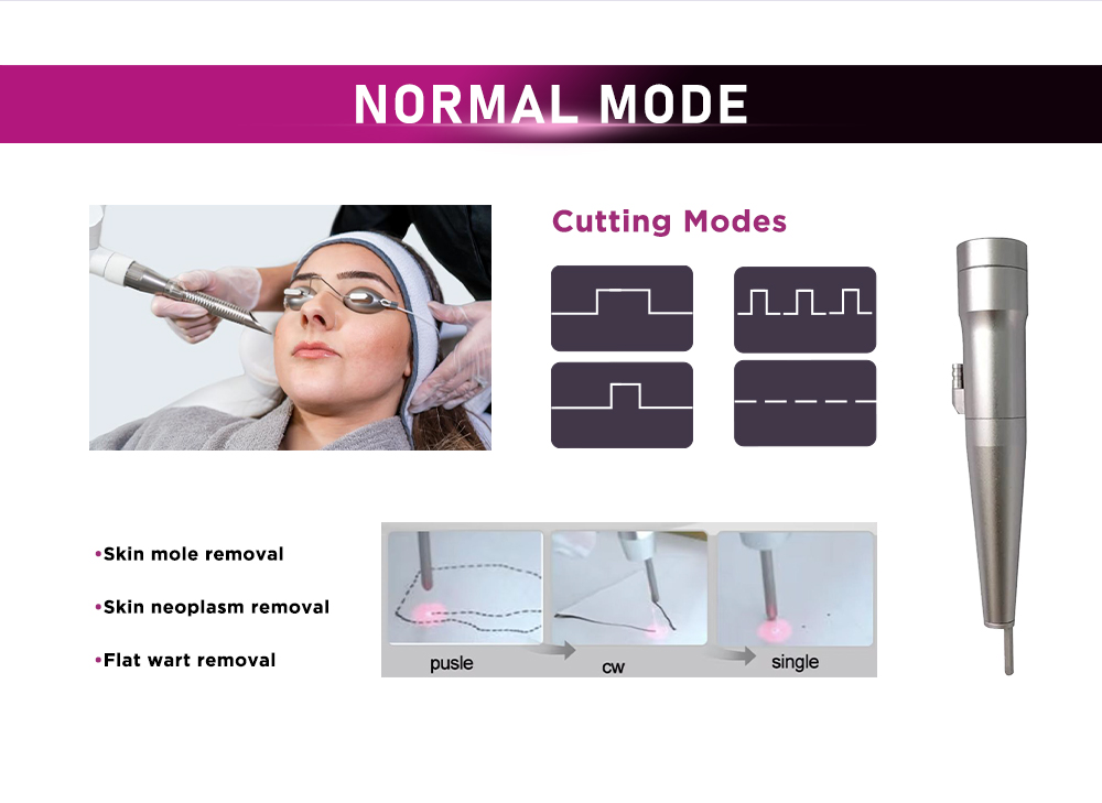CO2 Fractional Laser Detail 5